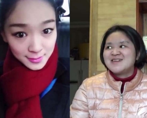 離奇墮樓失憶空姐3年後露面 喪失智力容貌大變