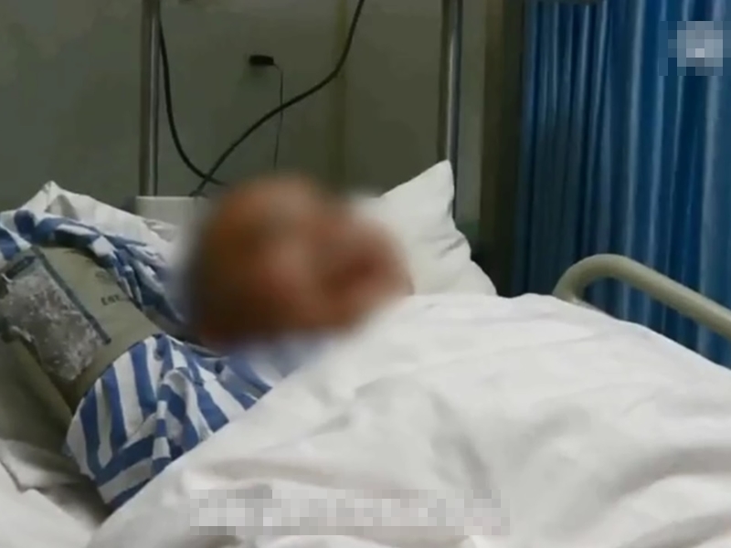 湖南一名男子因生吞魚膽結果引發急性中毒被送進醫院。 網上圖片
