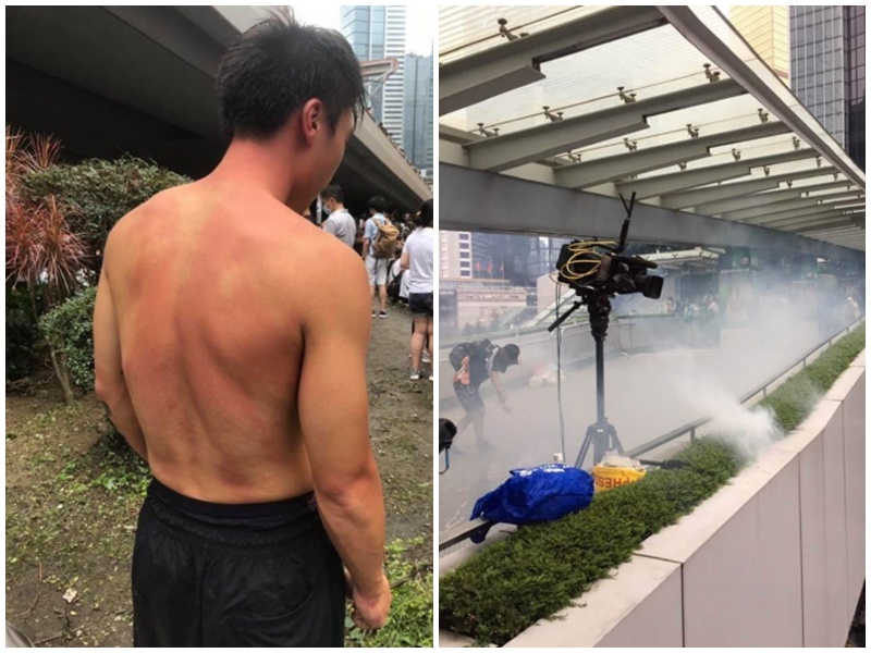 有記者指證遭警方近距離發射催淚氣體。
