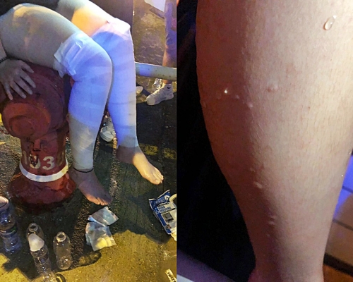 鴨脷洲邨腐液從天降 至少7男女傷