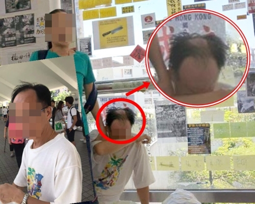 馬鞍山「撕紙」中年漢傳被剃頭 報警稱遭人淋潑液體