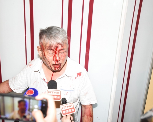 【修例風波】元朗最少3漢遭多人圍毆 白衣人疑打人後被圍毆