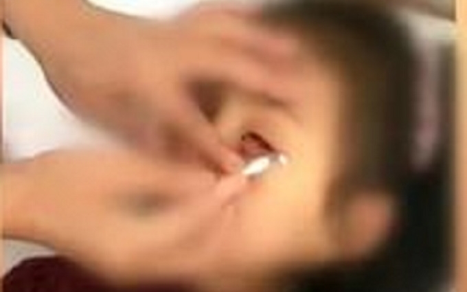 河南女童眼睛被塞紙片 檢查後稱無異獲賠償