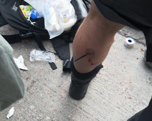 【修例風波】傳媒聯絡隊警員左小腿中箭 受傷送院
