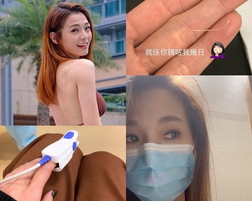 【頑強的魚骨】呂慧儀鯁骨咳到出血 入院求醫脫險