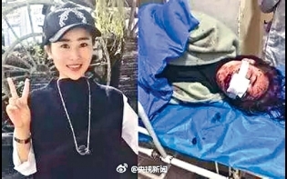 女子遊麗江遭毆打毀容 六被告罪成判監