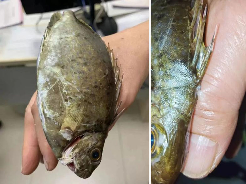 泥鯭魚鰭扎進手指女子舉魚求診醫生讚 不硬拔是對的 頭條日報