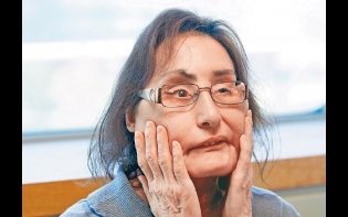 美首名換臉女離世享年57 曾接受30次臉部整形手術