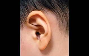 玲瓏美集——按摩耳勝過服人參