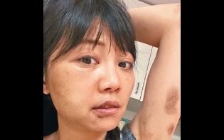 哭訴被男友虐待經過 台民進黨女神:他連母親也打